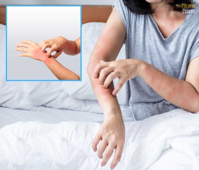 Dị ứng thời tiết